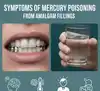 Symptoms of Mercury Poisoning from Amalgam Fillings – Maybe It's Mercury